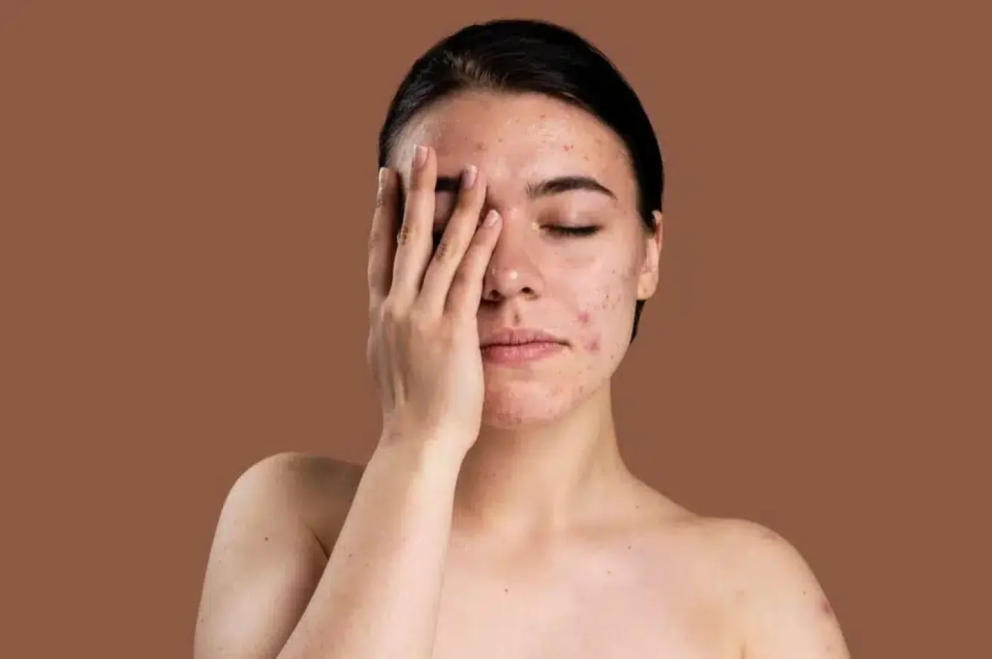 Fakta Menarik: Apakah Manusia Bisa Berganti Kulit Seperti Hewan?