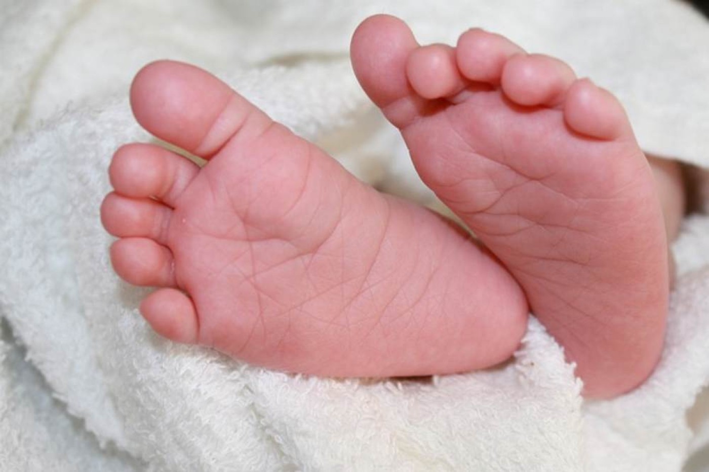 Gejala dan Penyebab Sindrom Cloves, Penyakit Langka pada Anak-anak