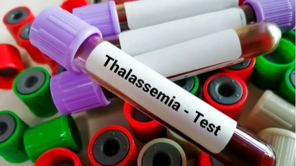 Perawatan Komprehensif Thalasemia: Transfusi Darah & Dukungan Psikologis Terpadu