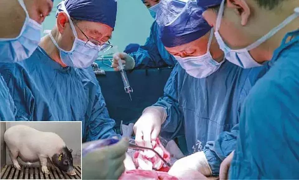 Sejarah Baru Medis: Transplantasi Hati Babi Berhasil pada Manusia Pertama Kali