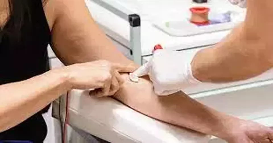 3 Tanda Kolesterol Tinggi di Mata dan Tangan yang Wajib Anda Waspadai