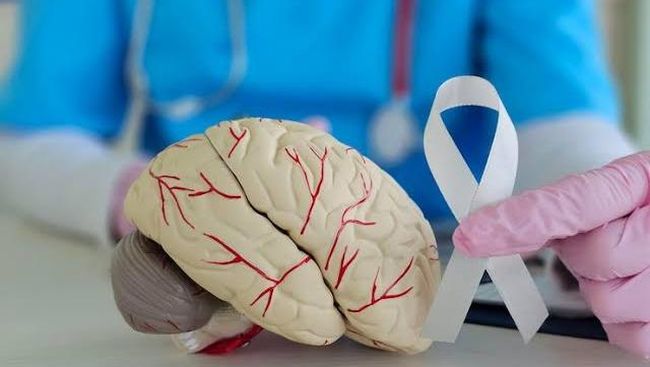 5 Kebiasaan Buruk yang Merusak Otak dan Cara Menghindarinya untuk Kesehatan Optimal