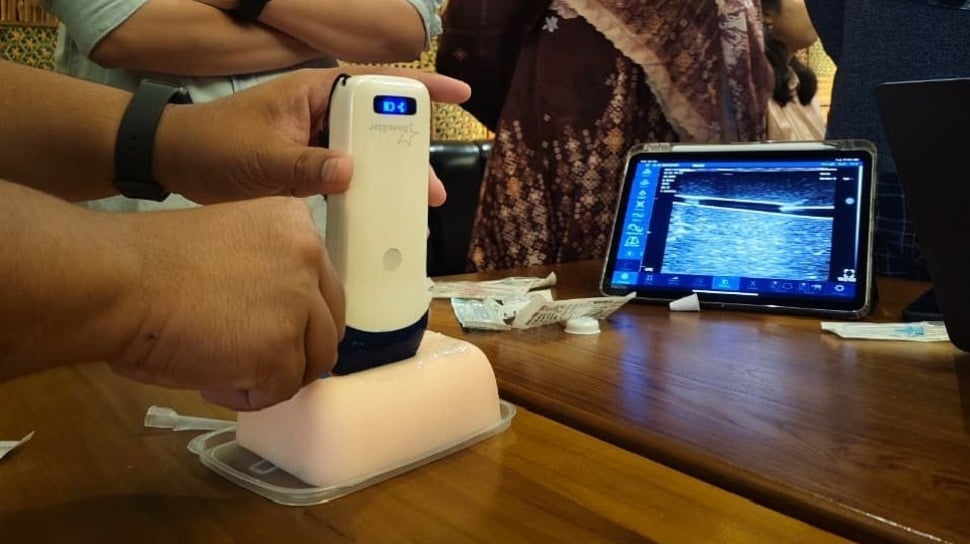 Infus Gagal Sebabkan Sakit dan Trauma? Kenali Keunggulan USG untuk Akses Pembuluh Darah! Infus Gagal Sebabkan Sakit dan Trauma? Kenali Keunggulan USG untuk Akses Pembuluh Darah!