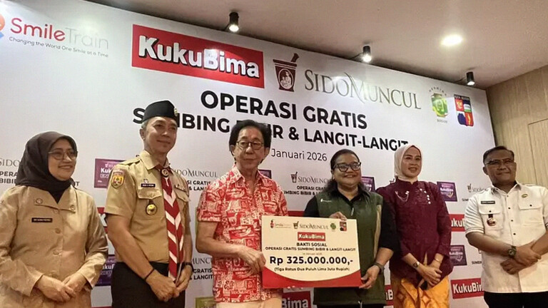 Sido Muncul Bersama Smile Train Tawarkan Operasi Sumbing Bibir Gratis untuk Warga Bogor