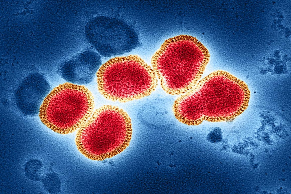 Mengenal Super Flu: Fakta, Risiko, dan Cara Pencegahannya yang Perlu Anda Tahu