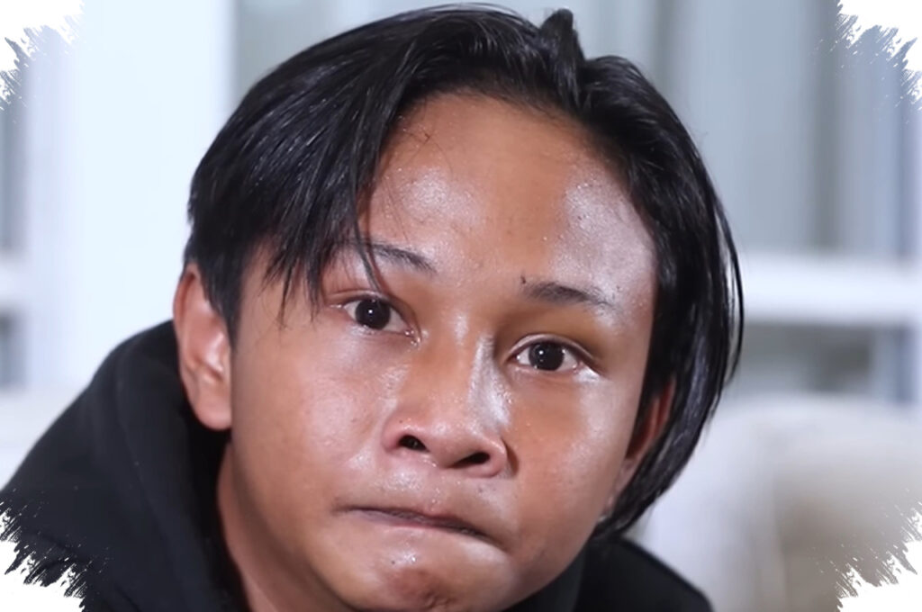 Fajar Sadboy Jatuh di Jakarta Timur, Tangan Kirinya Retak Usai Motor Tergelincir