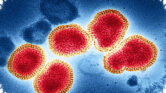 Strain Andes di MV Hondius, Ancaman Hantavirus yang Bisa Menular Antar Manusia Strain Andes di MV Hondius, Ancaman Hantavirus yang Bisa Menular Antar Manusia