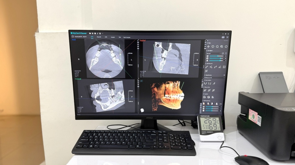 Rontgen Gigi 3D Mengubah Diagnosis, Detail Rahang Terbaca Dalam Hitungan Menit