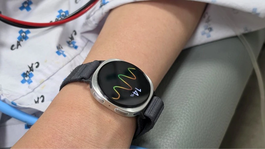 Samsung Ubah Galaxy Watch Jadi Pelatih Kesehatan AI, Bukan Lagi Sekadar Penghitung Langkah