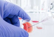 Stem Cell Makin Dekat Ke Pasien, Dari Kulit Awet Hingga Sendi Pulih