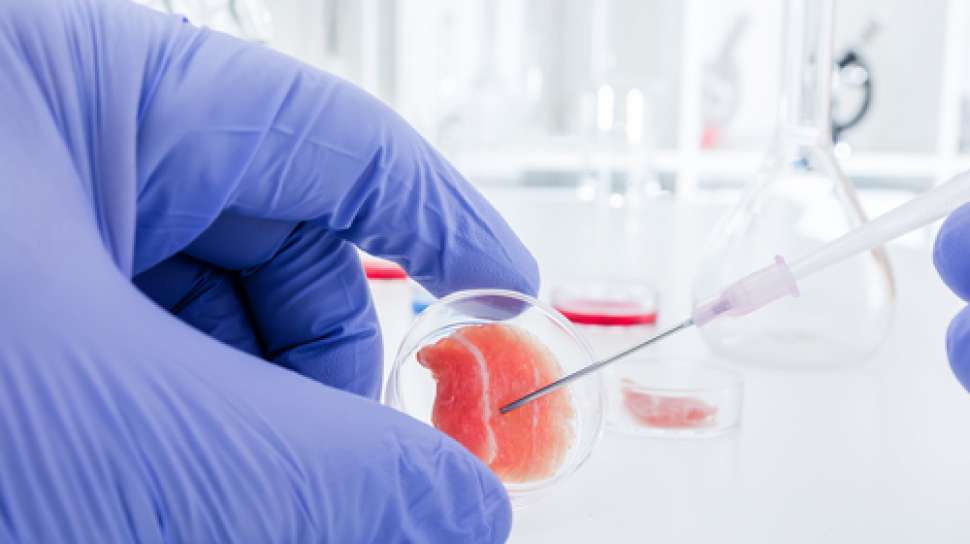 Stem Cell Makin Dekat Ke Pasien, Dari Kulit Awet Hingga Sendi Pulih