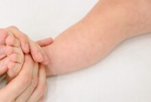 Dermatitis Bayi Meningkat, Rahasia Cegah Eksim Kambuh Ada Pada Skin Barrier