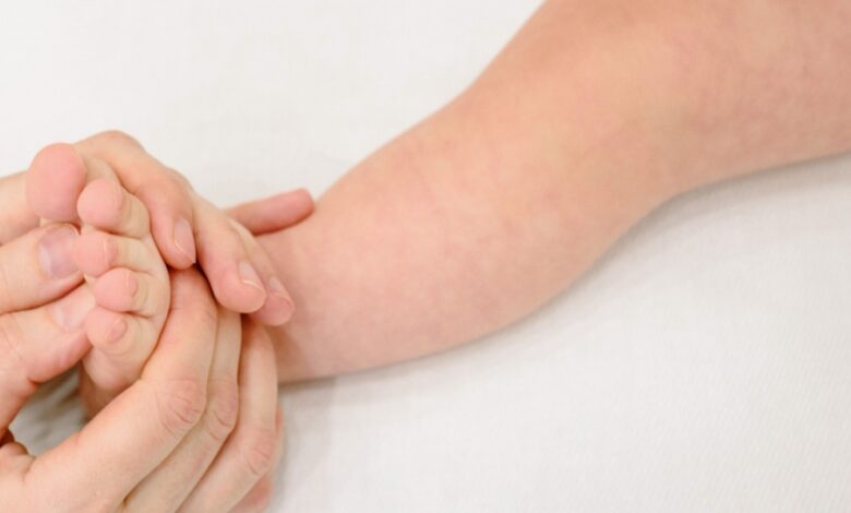 Dermatitis Bayi Meningkat, Rahasia Cegah Eksim Kambuh Ada Pada Skin Barrier
