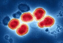Flu Singapura Merebak di Sumsel, 523 Suspek Tersebar di 16 Daerah