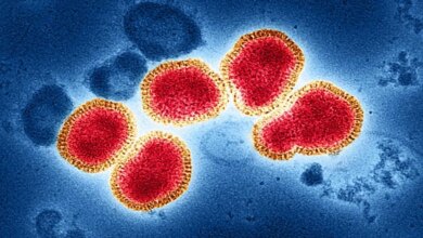 Flu Singapura Merebak di Sumsel, 523 Suspek Tersebar di 16 Daerah