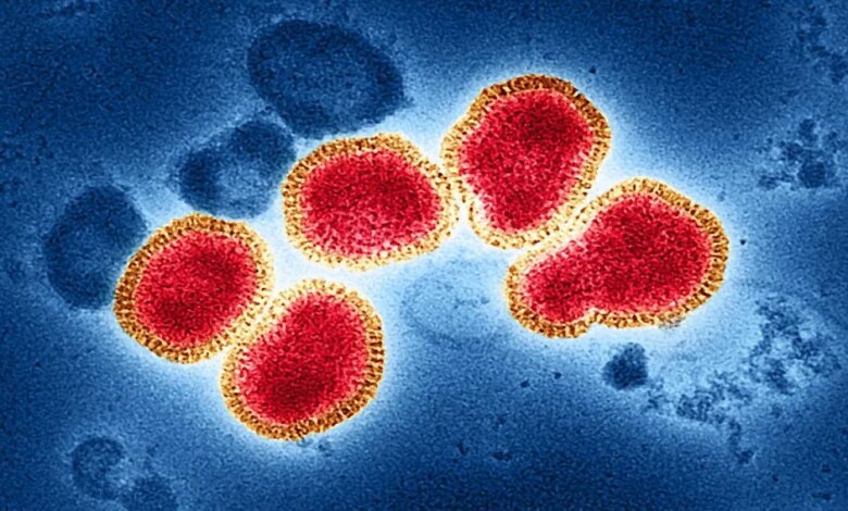 Flu Singapura Merebak di Sumsel, 523 Suspek Tersebar di 16 Daerah