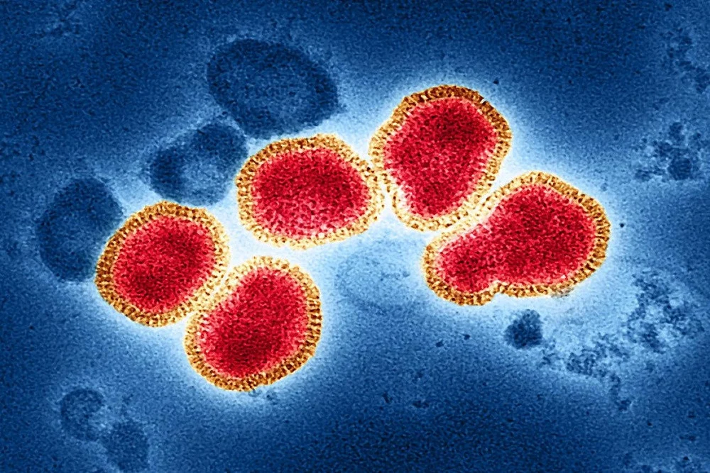 Flu Singapura Merebak di Sumsel, 523 Suspek Tersebar di 16 Daerah