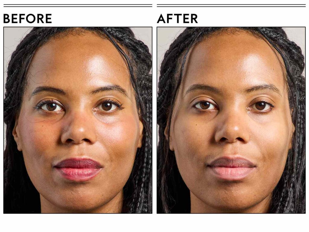 Bye Minyak Berlebih, 5 Micellar Water Ini Bantu Wajah Tetap Matte Seharian