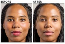 Bye Minyak Berlebih, 5 Micellar Water Ini Bantu Wajah Tetap Matte Seharian