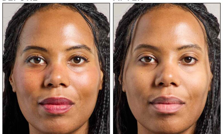 Bye Minyak Berlebih, 5 Micellar Water Ini Bantu Wajah Tetap Matte Seharian