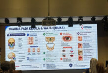 Trauma Kepala Hingga Perut, Tanda Bahaya Dan Penanganan yang Menentukan Nyawa