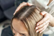 Scalp T-Zone Sering Dilupakan, Padahal Di Sini Rambut Mulai Menipis Duluan