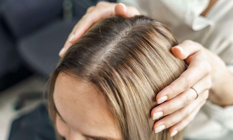Scalp T-Zone Sering Dilupakan, Padahal Di Sini Rambut Mulai Menipis Duluan